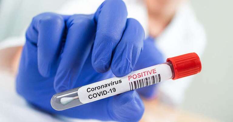 coronavirus-covid19-positivo