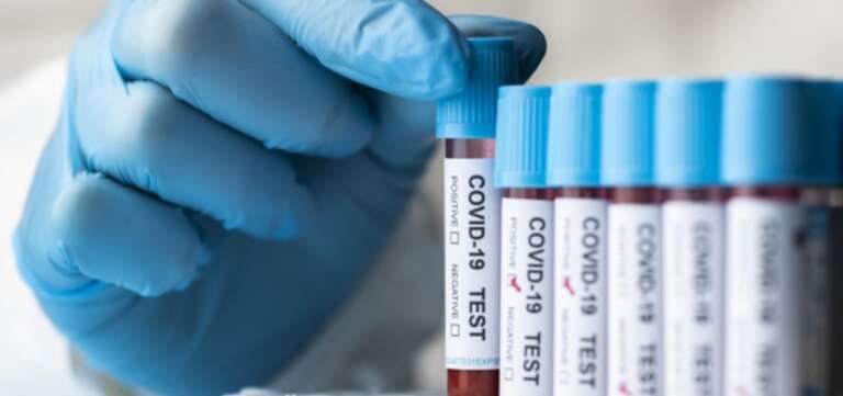 muestras-de-sangre-de-pacientes-positivos-en-covid-19