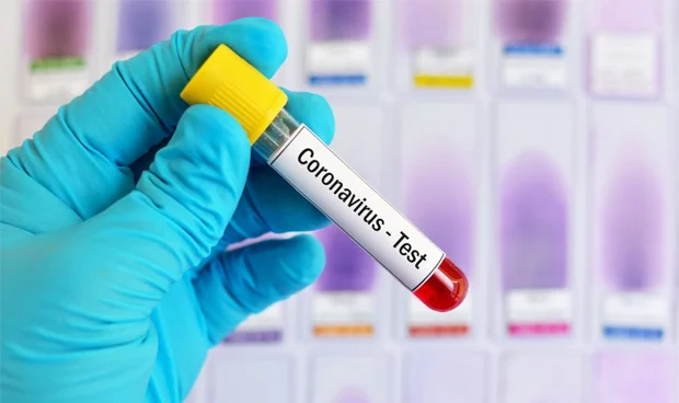 que-hacer-si-he-estado-con-un-covid-positivo