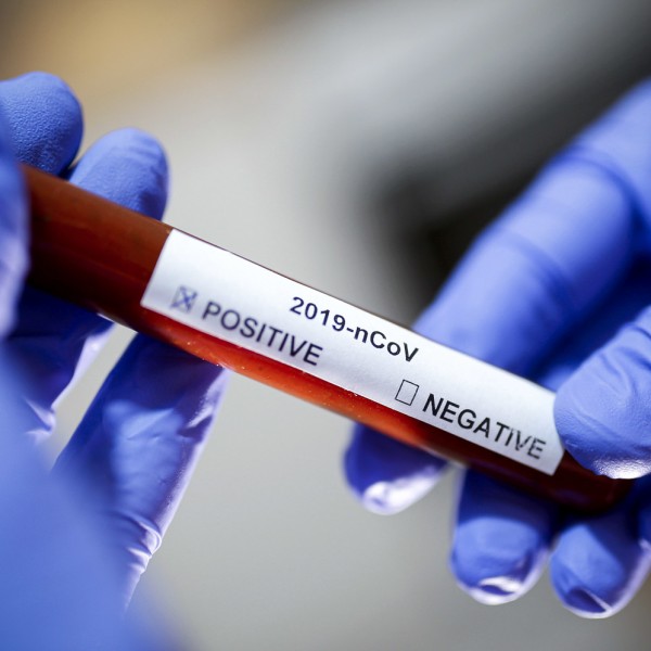 Coronavirus-positivo